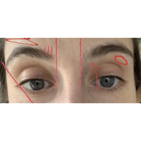 Example of edited brow photo